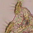 rotifer, a protozoan